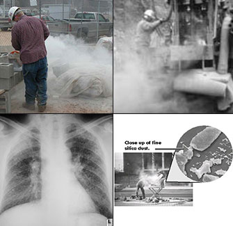 Workers Prone to Silicosis and the Effects